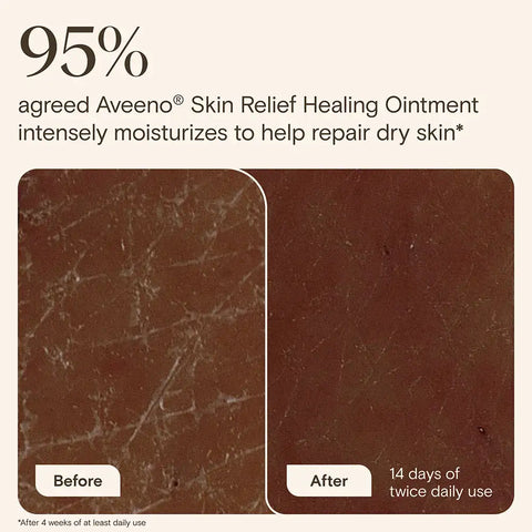 Skin Relief Healing Ointment for Dry Skin - 7.2oz