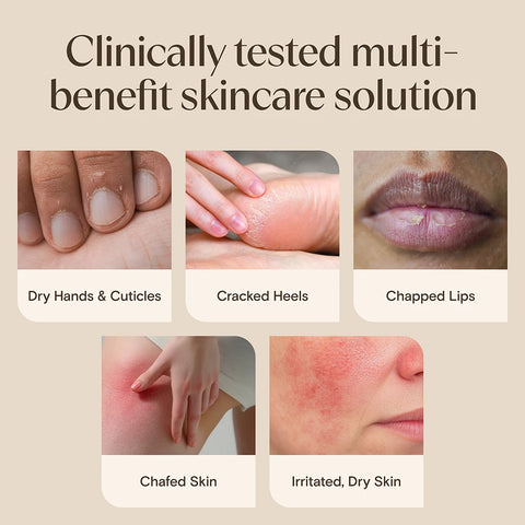 Skin Relief Healing Ointment for Dry Skin - 7.2oz