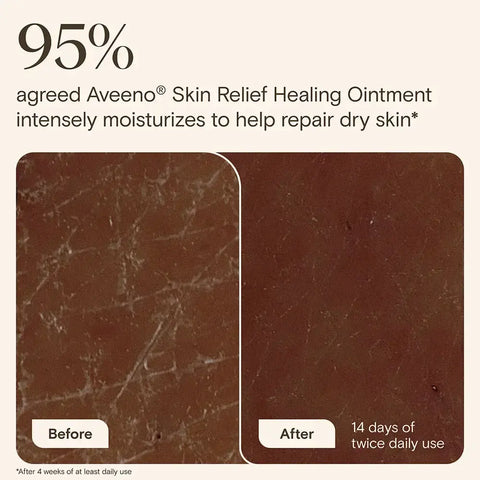 Skin Relief Healing Ointment for Dry Skin - 7.2oz